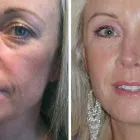 Business 2 image BEAUTIPHI Skin Treatments in Auckland NTL
