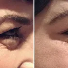 Business 4 image BEAUTIPHI Skin Treatments in Auckland NTL