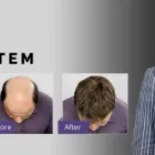 Business 1 image SUPERIOR HAIR REPLACEMENT Hairdressers in Auckland City AUK