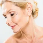 Business 1 image UNIQUE AESTHETIC - COSMETIC INJECTABLES, DERMAL FILLERS Skin Care in Henderson, Auckland AUK